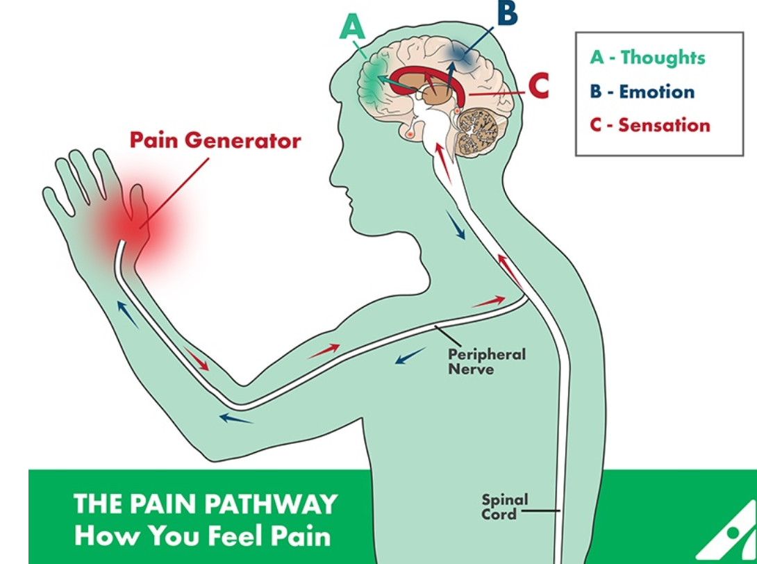 Effective pain relief - this picture shows a graphic of how the pain feels and how Tens works with electrode placement.